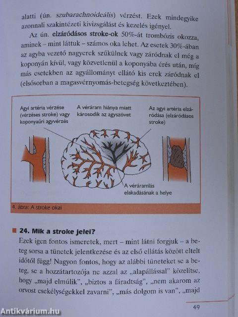 Trombózis és véralvadásgátlás