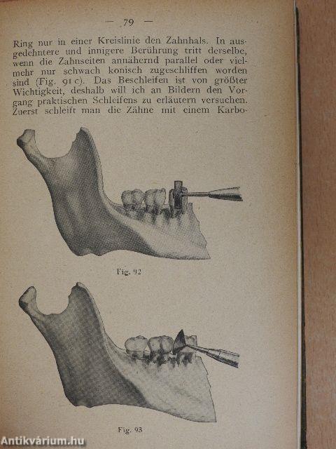 Lehrbuch und Atlas der Zahnärztlichen Technik