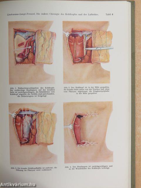 Die Chirurgie des Gesichts, der Mundhöhle und der Luftwege