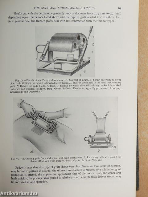 Operations of general surgery