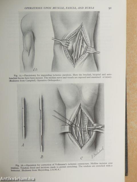 Operations of general surgery