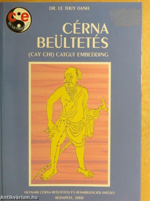 Cérna beültetés - DVD-vel