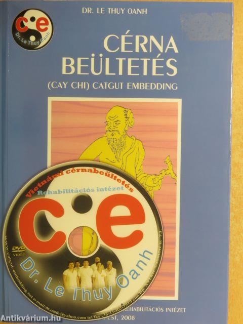 Cérna beültetés - DVD-vel