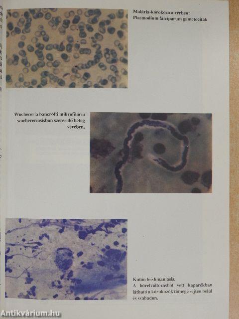 Fertőzések és trópusi betegségek