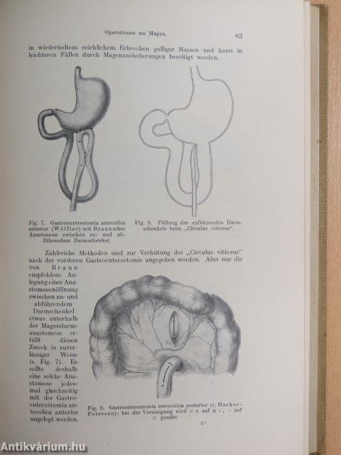 Lehrbuch der Chirurgie II.