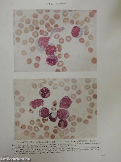 Hématologie Clinique