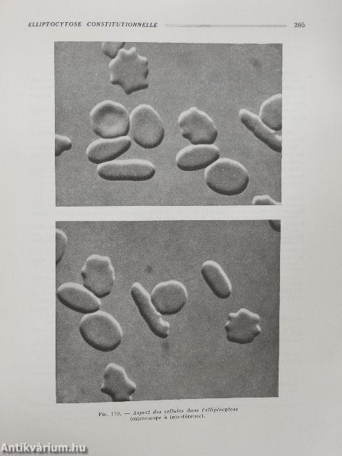 Hématologie Clinique