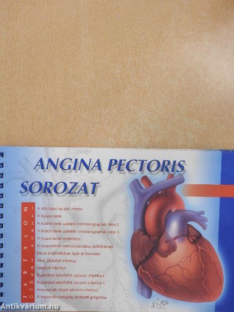 Angina pectoris sorozat