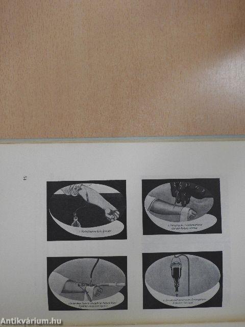 Erythroblastosis Foetalis und Blutaustausch