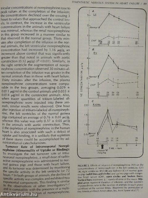 Congestive Heart Failure