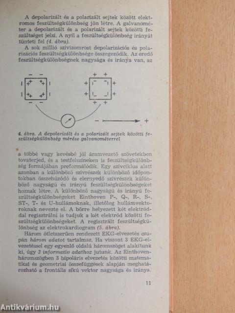 Gyakorlati elektrokardiográfia