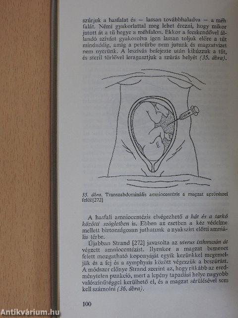 Magzatvíz-diagnosztika