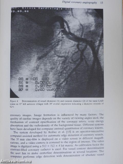 Interventional Techniques in Cardiovascular Medicine