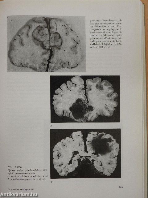 A klinikai neurologia alapjai