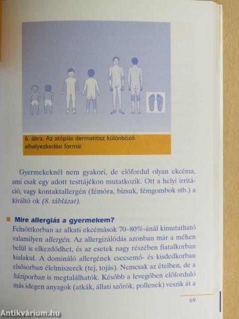 Gyermekkori allergiák
