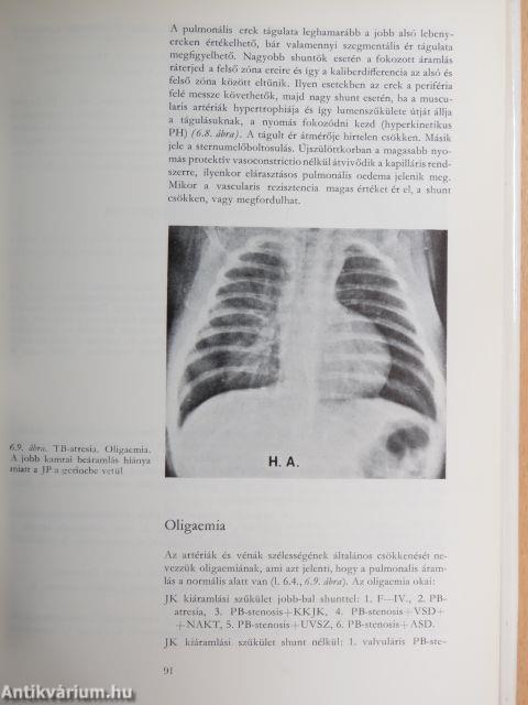 A veleszületett szívbetegségek klinikopatológiája