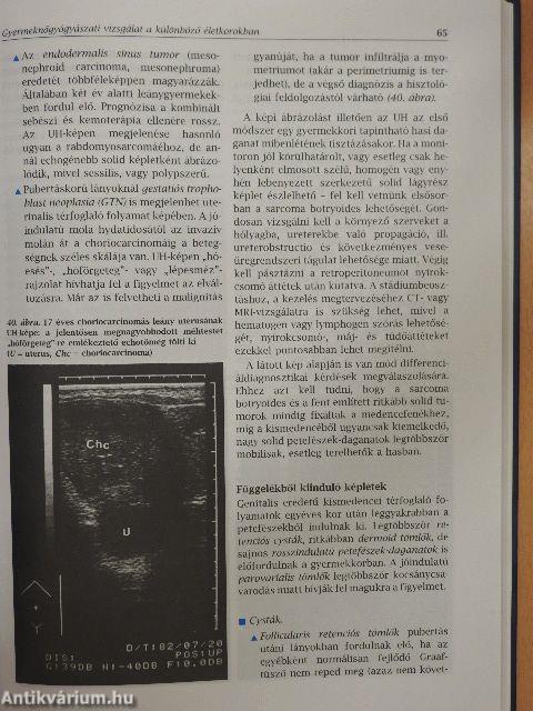 Gyermeknőgyógyászat