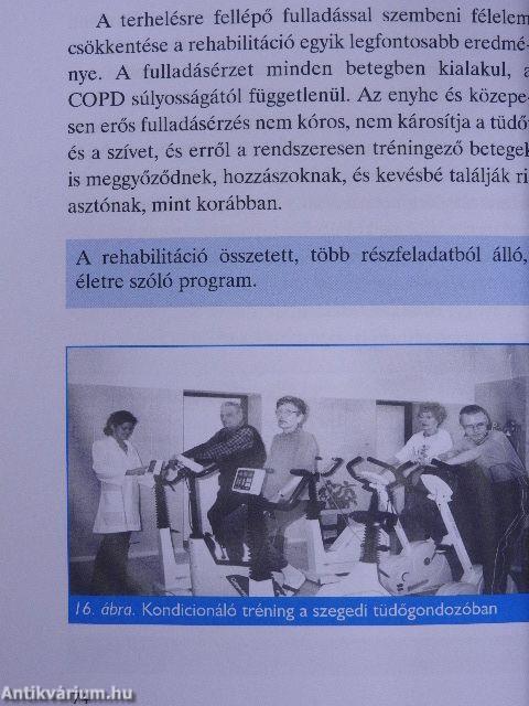 Fulladok, köhögök - COPD-s vagyok?