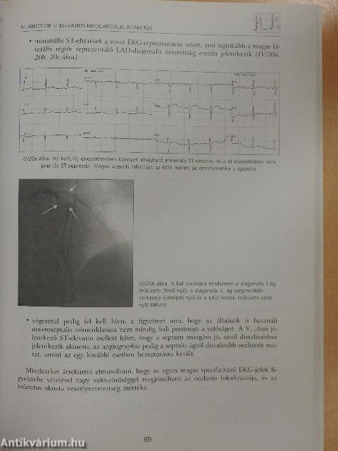 EKG a sürgősségi betegellátásban