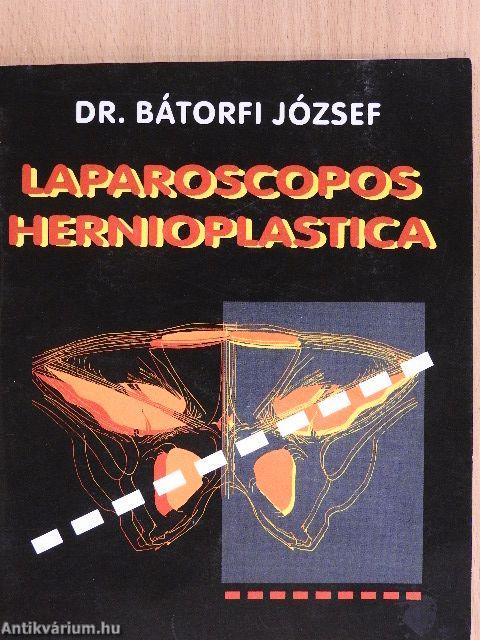 Laparoscopos hernioplastica