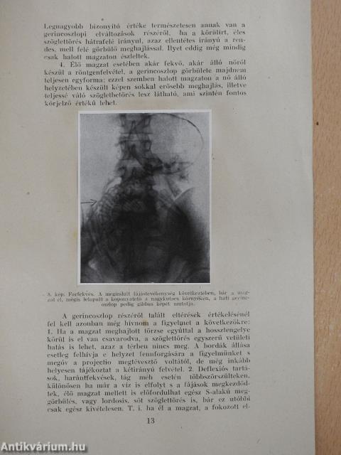 A szülészeti röntgendiagnostika útjai és vívmányai (dedikált példány)