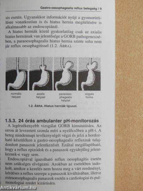 Gastro-oesophagealis reflux betegség, peptikus fekély és funkcionális dyspepsia