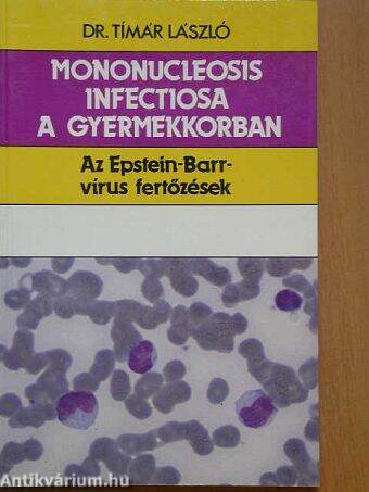 Mononucleosis infectiosa a gyermekkorban