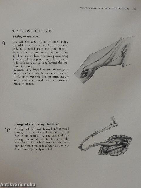 Vascular Surgery