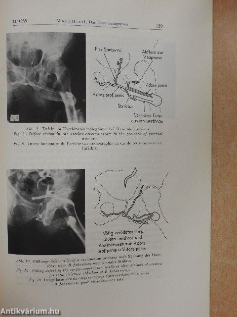 Urologia Internationalis 2/1955