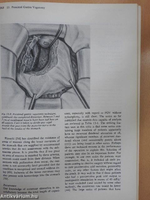 Surgery of the Stomach and Duodenum