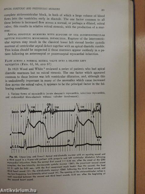 Heart Sounds and Murmurs