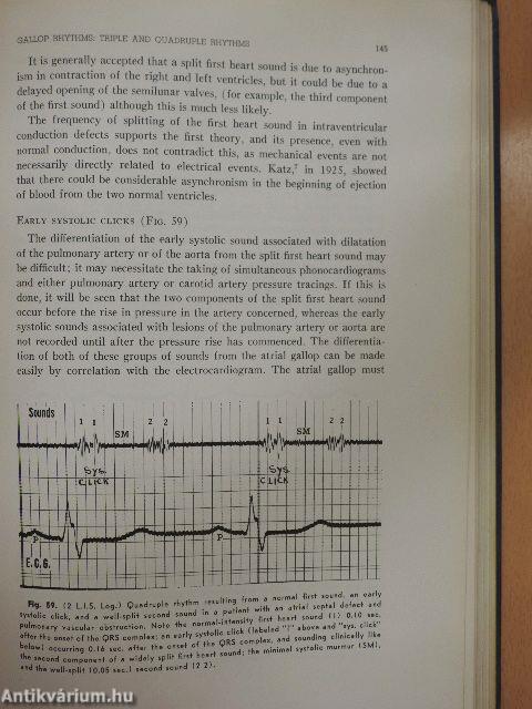 Heart Sounds and Murmurs