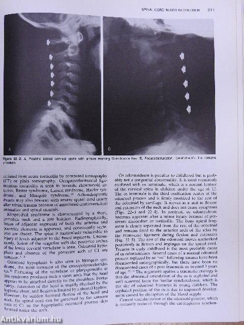 Textbook of Pediatric Critical Care