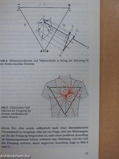 Elektrokardiographie