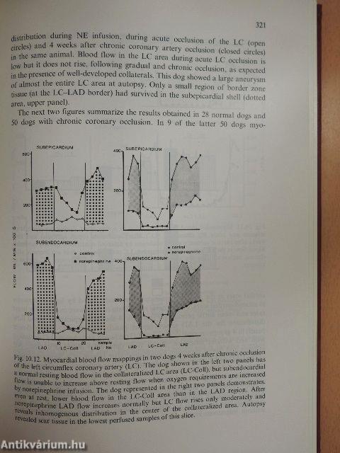 The Pathophysiology of Myocardial Perfusion