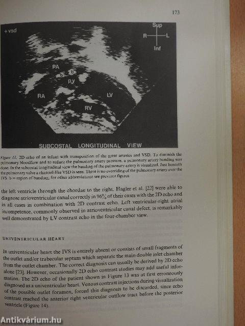 Contrast Echocardiography