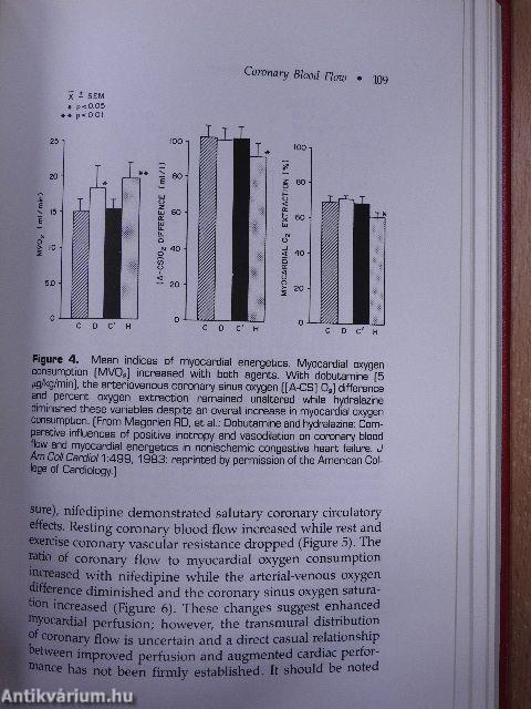 Dilated Cardiomyopathy