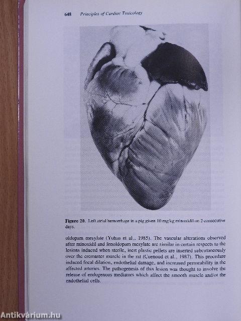 Principles of Cardiac Toxicology