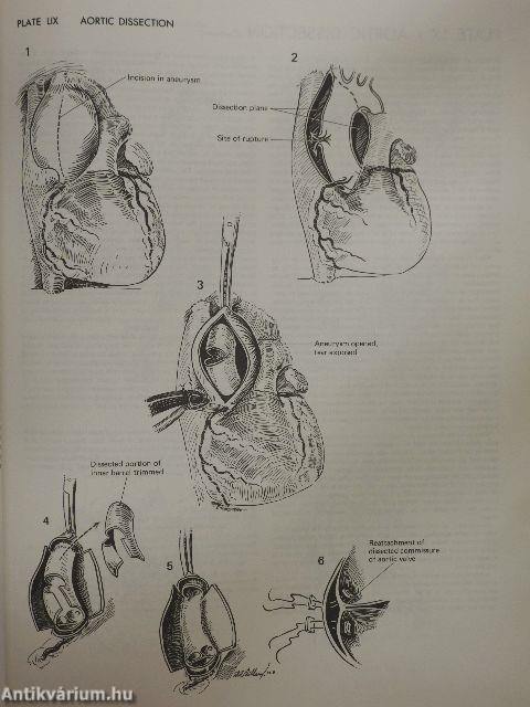 Atlas of Cardiac Surgery