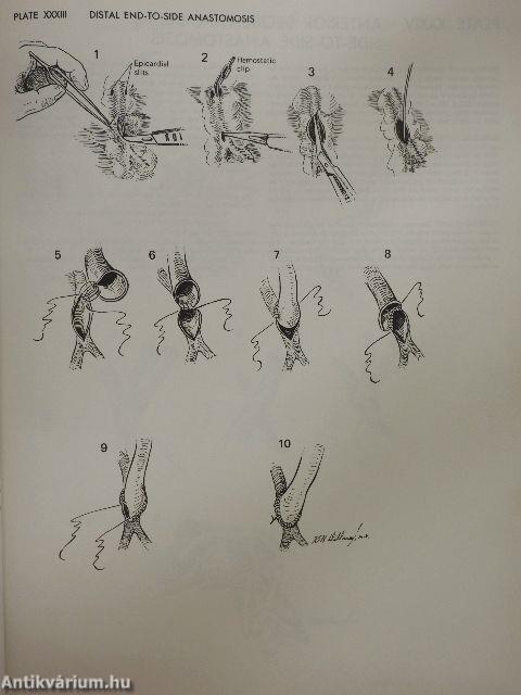 Atlas of Cardiac Surgery