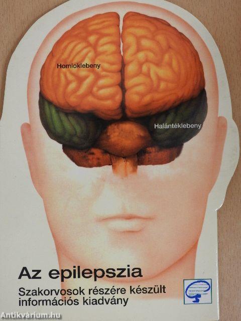 Az epilepszia