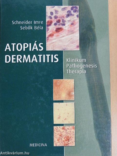 Atopiás dermatitis