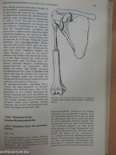 Orthopädische Operationen