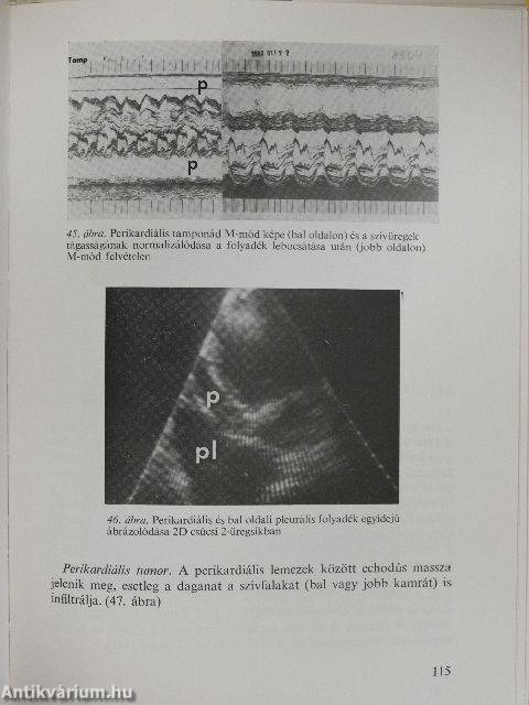 Pénzügyi közvetítő intézmények