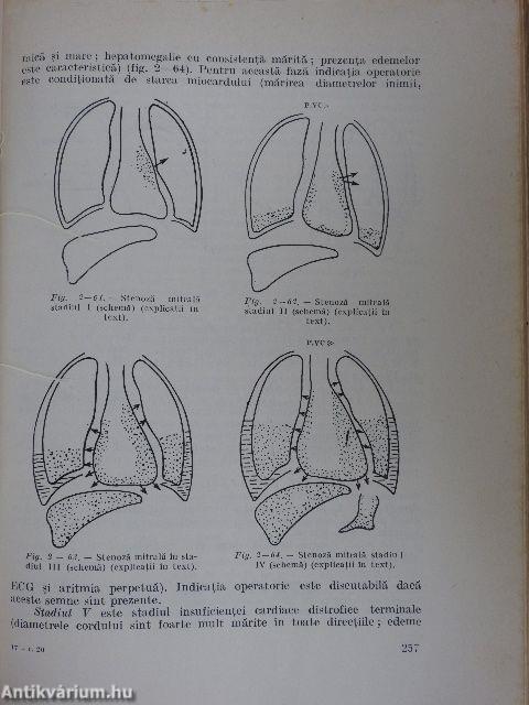 Patologie Chirurgicala IV.