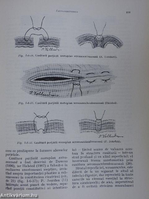 Elemente de Chirurgie Intestinala