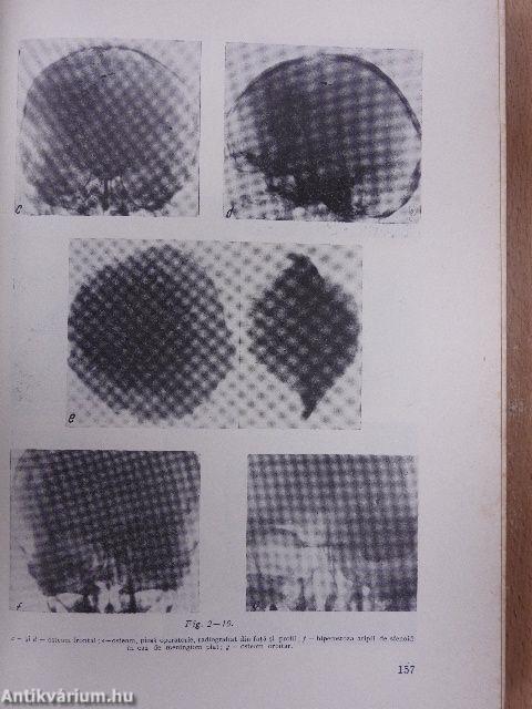 Patologie Chirurgicala III.