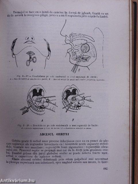 Patologie Chirurgicala III.
