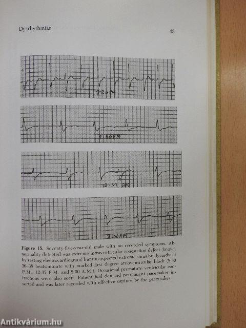 Dynamic Electrocardiographic Recording