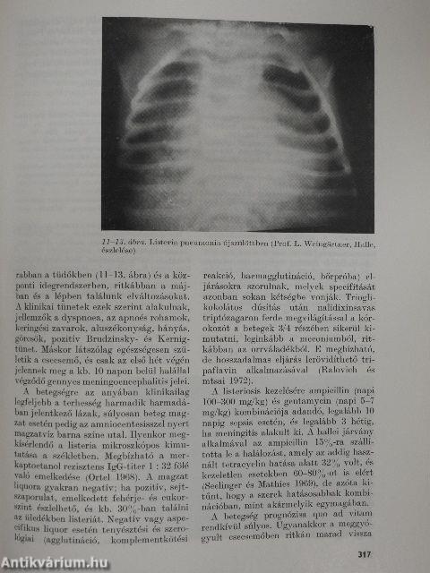 Az újszülött 1-3.